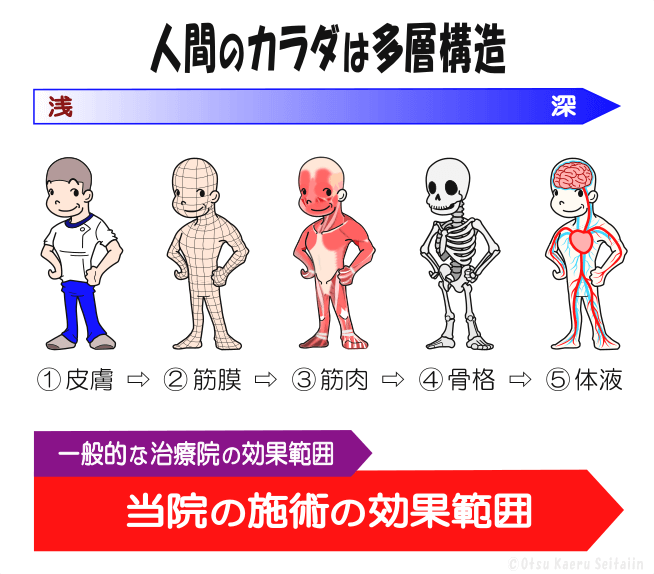 人体多層構造(皮膚・筋膜・筋肉・骨格・体液)。当院は④骨格・⑤体液まで整える