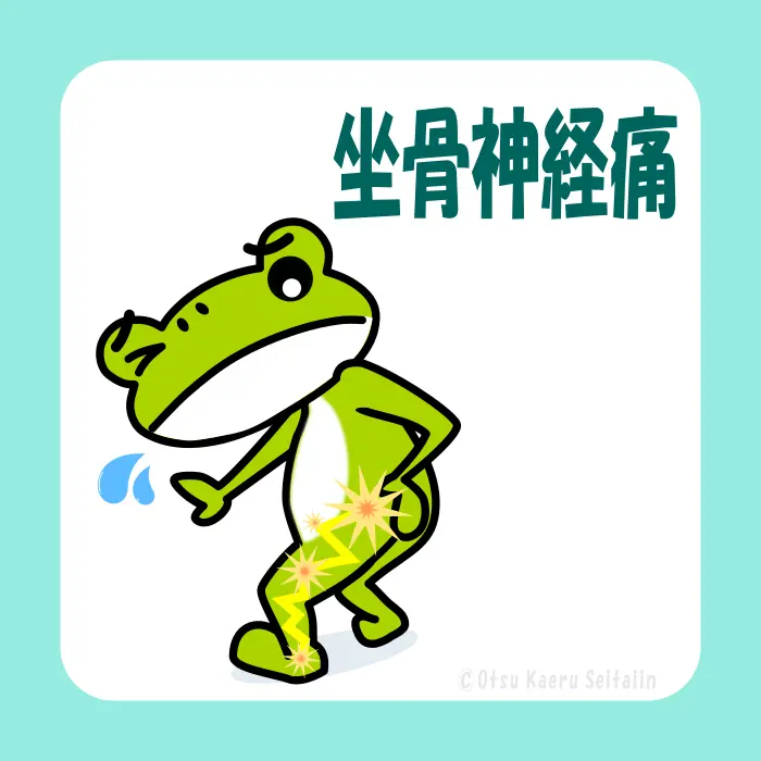 坐骨神経痛の症状ページ